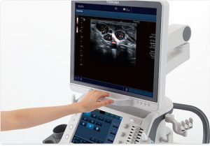 agoscopia prostata positiva cosa fare 2
